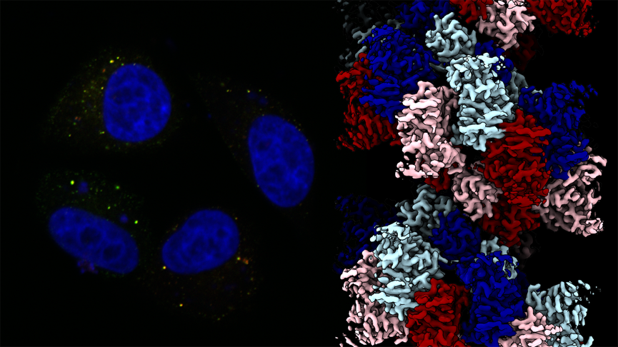 The signalling protein tankyrase forms punctate structures in cells (left). These puncta appear as tankyrase self-assembles into chain-like fibres. Cryo-electron microscopy of the isolated tankyrase protein enabled researchers to decipher the molecular structure of these fibres (right) and learn how tankyrase is activated by self-assembly.
