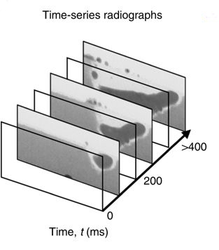 radiiographs