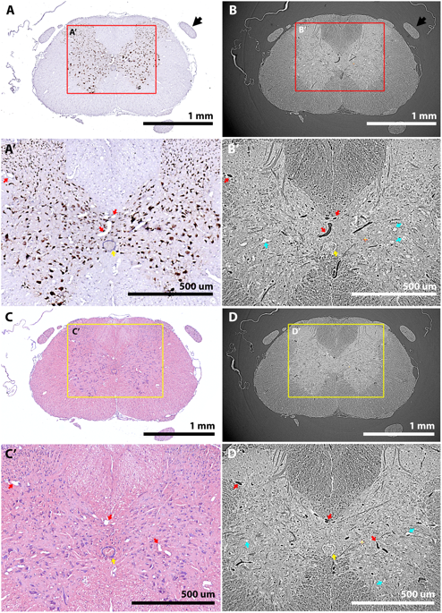 Wax-embedded tissue imaged by SRμCT is suitable for subsequent histology and the resulting images can be aligned to tomograms.