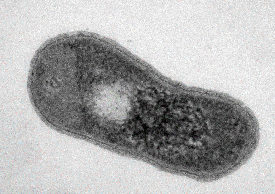 TEM image of Bacterium Gemmatimonas phototrophica – courtesy of Jason Dean BSc., Inst. Microbiology, Trebon, Czech Rep 
