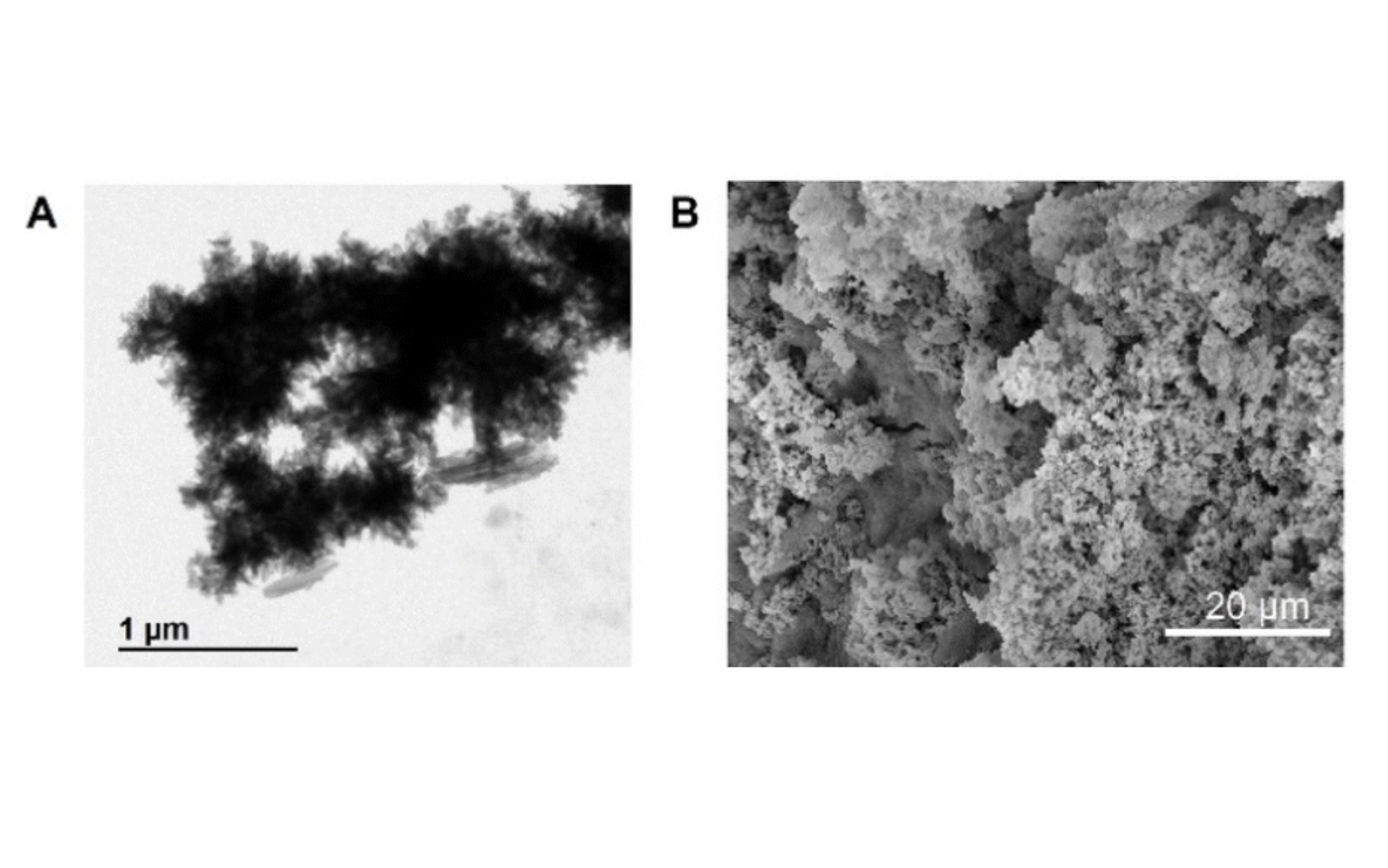 (A) TEM image of Fe-MOF@COF. (B) FE-SEM image of Fe-MOF@COF.