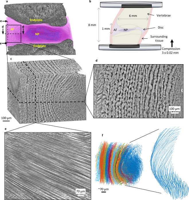 Fig. 1. Collagen bundle architecture of a whole intervertebral disc under compression resolved using synchrotron tomography. (a) Rendered tomogram of spine segment clipped through the sagittal plane. (b) In situ imaging setup. (c) Anterior region of interest rendering. (d) Transverse slice across anterior volume showing lamellae across the full thickness of the AF are resolved. (e) Slice across anterior volume showing collagen fibre bundles in a single lamella. (f) >10k individual collagen fibre bundles traced across the anterior volume. Fibres are defined by closely spaced points (8 µm) and labelled by lamella.<br/>Image reused from DOI: 10.1016/j.actbio.2021.10.012 under the CC BY 2.0 license.