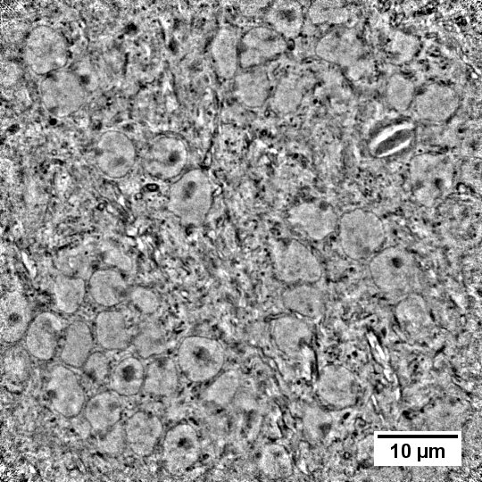 mouse brain 60nm